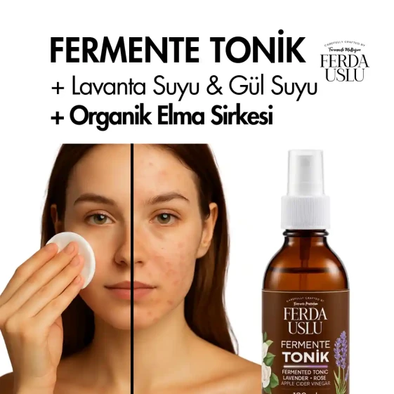 Fermente Tonik (Gül-Lavanta) - 3 Adet-Elma Sirkeli Gözenek Sıkılaştırıcı, Canlandırıcı 100 ML - 2