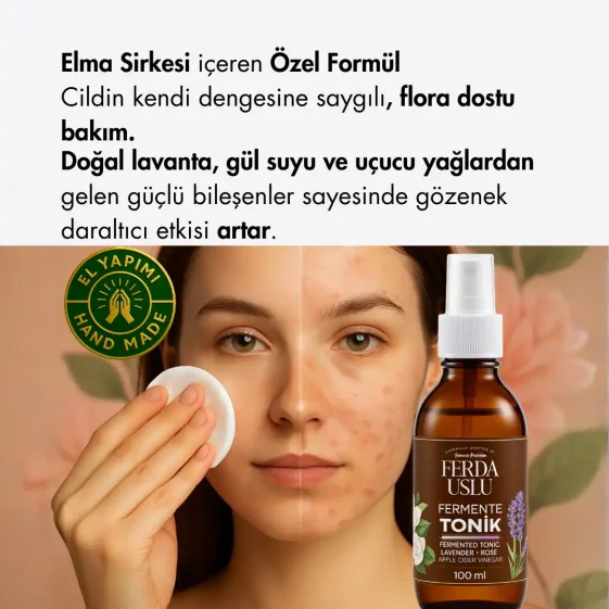 Fermente Tonik (Gül-Lavanta) - Elma Sirkeli Gözenek Sıkılaştırıcı, Canlandırıcı 100 ML - 4